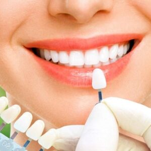 Sứ Ceramill bảo hành 12 năm