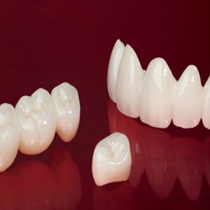 Sứ Venus bảo hành 10 năm