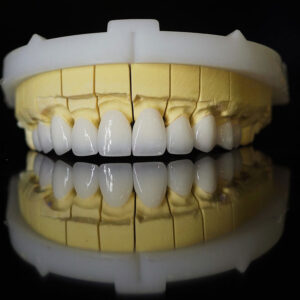 Sứ Lava bảo hành 20 năm