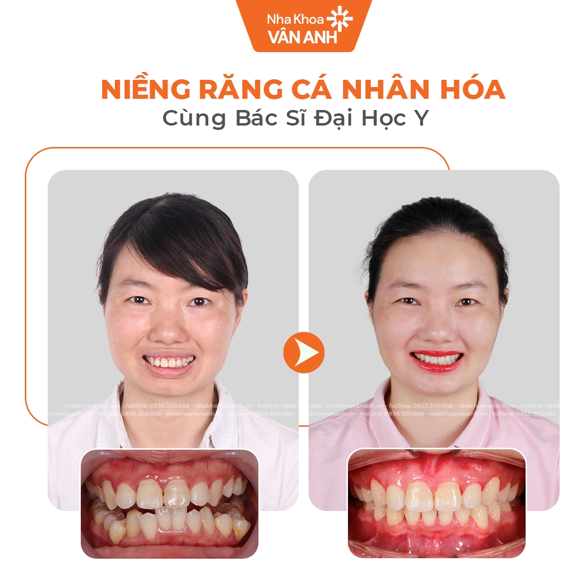 Kim loại thường - Ảnh 3