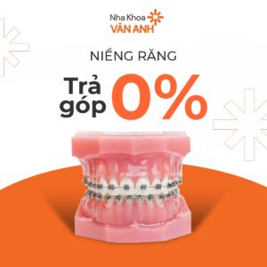 Kim loại thường