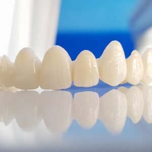 Sứ Zirconia bảo hành 7 năm