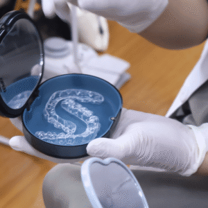 Niềng máng trong suốt Techlign