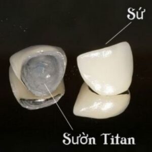 Sứ Titan Mỹ bảo hành 2 năm
