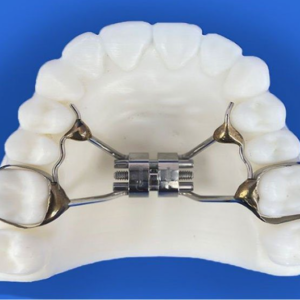 Ốc nong xương Marpe